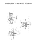 COIL ELECTRODE APPARATUS FOR THERMAL THERAPY FOR TREATING BONE TISSUE diagram and image