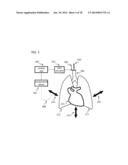 Method and Apparatus for Improved Ventilation and Cardio-Pulmonary     Resuscitation diagram and image