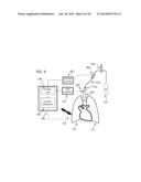 Method and Apparatus for Improved Ventilation and Cardio-Pulmonary     Resuscitation diagram and image