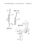 ELBOW BRACE diagram and image