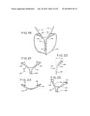 ORAL MOUTHPIECE AND METHOD FOR THE USE THEREOF diagram and image