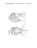 ORAL MOUTHPIECE AND METHOD FOR THE USE THEREOF diagram and image