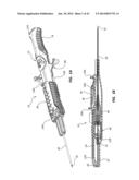 Catheter Placement Device and Method diagram and image