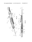 Catheter Placement Device and Method diagram and image