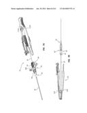 Catheter Placement Device and Method diagram and image