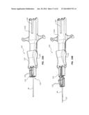 Catheter Placement Device and Method diagram and image