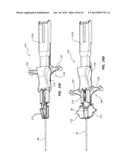 Catheter Placement Device and Method diagram and image