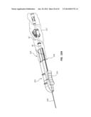 Catheter Placement Device and Method diagram and image