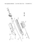 Catheter Placement Device and Method diagram and image