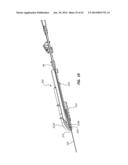 Catheter Placement Device and Method diagram and image