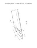 Catheter Placement Device and Method diagram and image