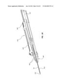 Catheter Placement Device and Method diagram and image