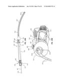 Catheter Placement Device and Method diagram and image