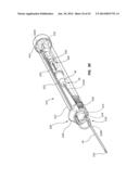 Catheter Placement Device and Method diagram and image