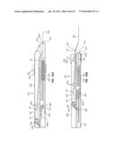 Catheter Placement Device and Method diagram and image