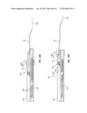 Catheter Placement Device and Method diagram and image