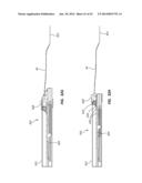 Catheter Placement Device and Method diagram and image