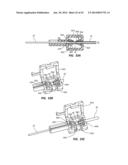 Catheter Placement Device and Method diagram and image