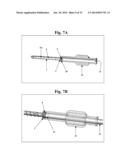 BONE SCREWS AND METHODS OF USE THEREOF diagram and image