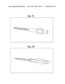 BONE SCREWS AND METHODS OF USE THEREOF diagram and image