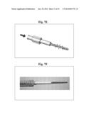 BONE SCREWS AND METHODS OF USE THEREOF diagram and image