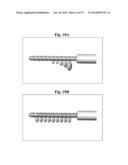 BONE SCREWS AND METHODS OF USE THEREOF diagram and image