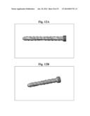 BONE SCREWS AND METHODS OF USE THEREOF diagram and image