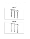 BONE SCREWS AND METHODS OF USE THEREOF diagram and image