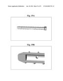 BONE SCREWS AND METHODS OF USE THEREOF diagram and image