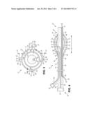 Catheters and Methods for the Treatment of Bodily Passages diagram and image