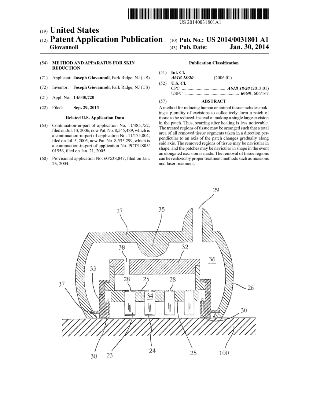 METHOD AND APPARATUS FOR SKIN REDUCTION - diagram, schematic, and image 01