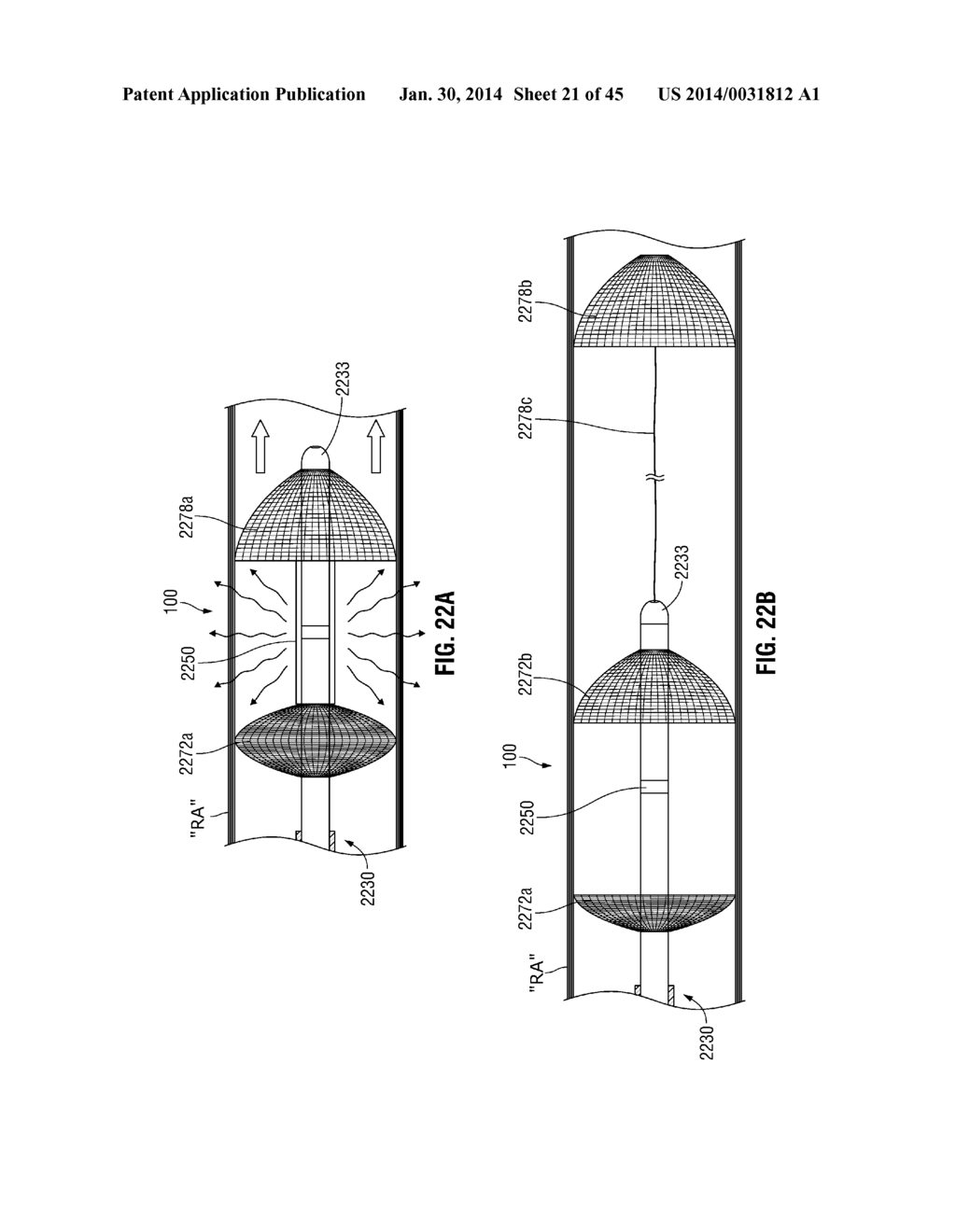 FLEXIBLE MICROWAVE CATHETERS FOR NATURAL OR ARTIFICIAL LUMENS - diagram, schematic, and image 22