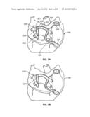 METHOD AND DEVICES FOR PERFORMING BIATRIAL COAGULATION diagram and image