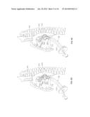 METHOD AND DEVICES FOR PERFORMING BIATRIAL COAGULATION diagram and image