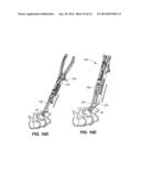 BONE FASTENER ASSEMBLY INSTRUMENT diagram and image