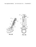 BONE FASTENER ASSEMBLY INSTRUMENT diagram and image