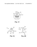 SYSTEMS, TOOLS, AND METHODS FOR CONNECTING TO TISSUE diagram and image