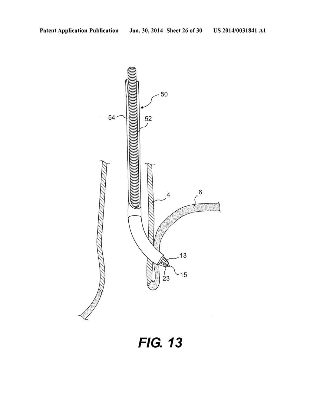 TISSUE FASTENERS AND RELATED DEPLOYMENT SYSTEMS AND METHODS - diagram, schematic, and image 27