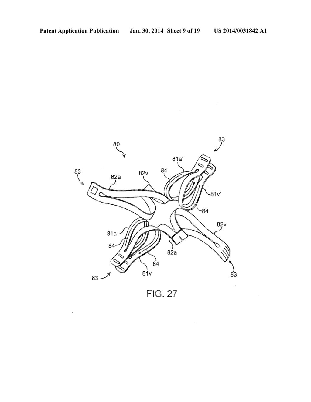 DEVICE AND METHOD FOR ESTABLISHING AN ARTIFICIAL ARTERIO-VENOUS FISTULA - diagram, schematic, and image 10