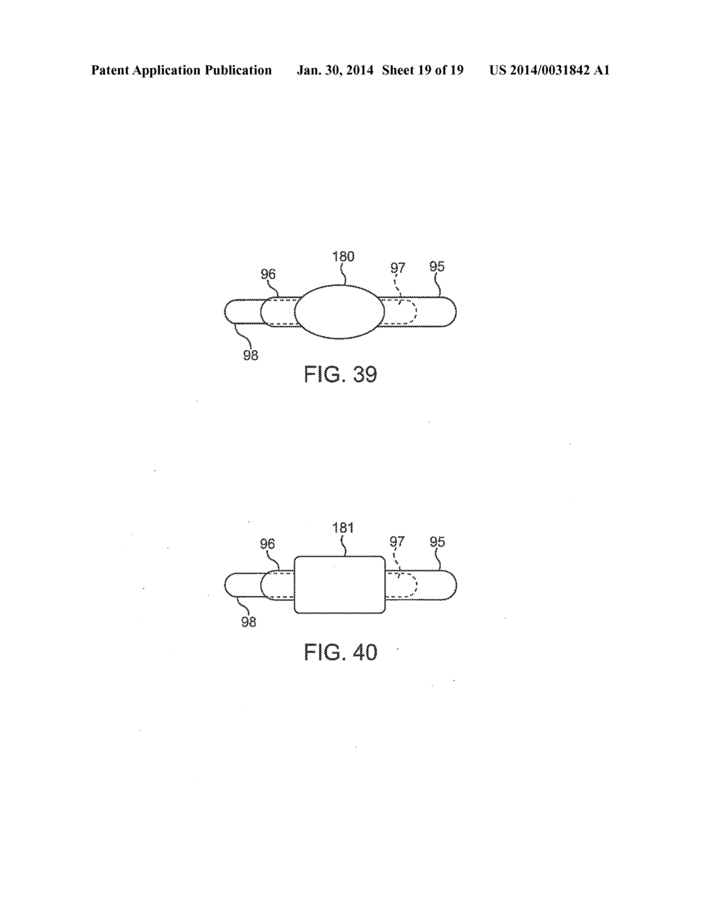 DEVICE AND METHOD FOR ESTABLISHING AN ARTIFICIAL ARTERIO-VENOUS FISTULA - diagram, schematic, and image 20