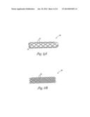 EMBOLIC FILTERS WITH CONTROLLED PORE SIZE diagram and image