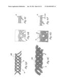 EMBOLIC FILTERS WITH CONTROLLED PORE SIZE diagram and image