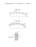 EMBOLIC FILTERS WITH CONTROLLED PORE SIZE diagram and image