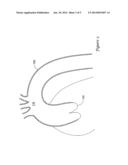 EMBOLIC PROTECTION FILTER FOR TRANSCATHETER AORTIC VALVE REPLACEMENT AND     USES THEREOF diagram and image