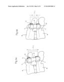 FLEXIBLE STABILIZATION DEVICE FOR DYNAMIC STABILIZATION OF BONES OR     VERTEBRAE diagram and image