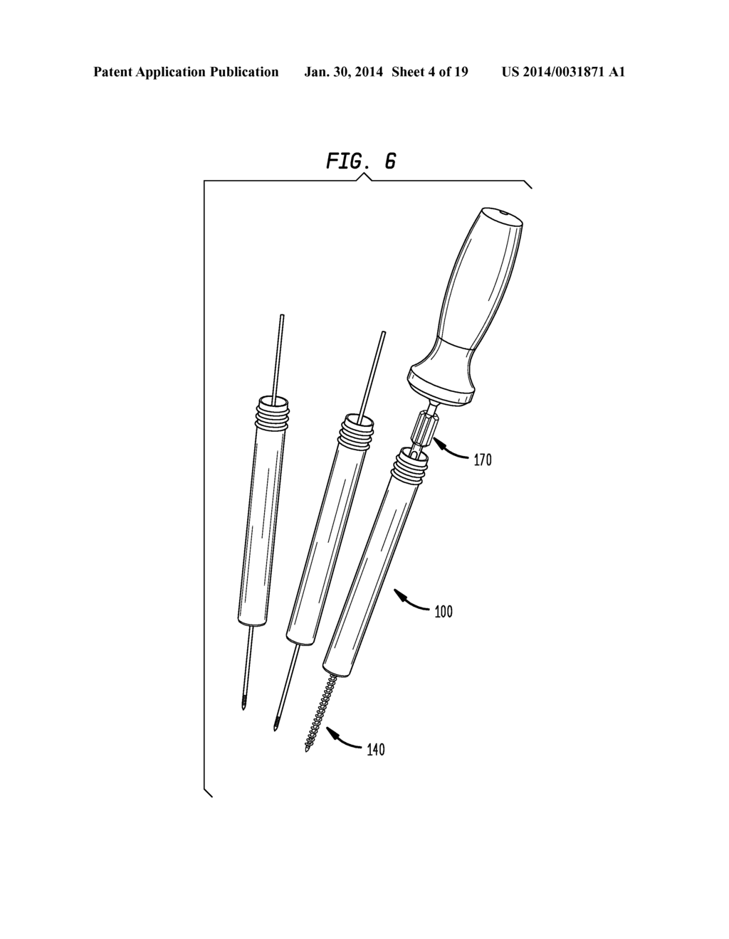 ROD CONTOURING METHOD FOR PERCUTANEOUS PEDICLE SCREW EXTENSION - diagram, schematic, and image 05