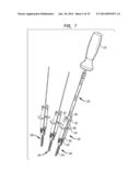 ROD CONTOURING METHOD FOR PERCUTANEOUS PEDICLE SCREW EXTENSION diagram and image