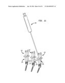 ROD CONTOURING METHOD FOR PERCUTANEOUS PEDICLE SCREW EXTENSION diagram and image