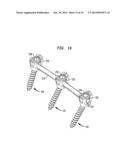 ROD CONTOURING METHOD FOR PERCUTANEOUS PEDICLE SCREW EXTENSION diagram and image