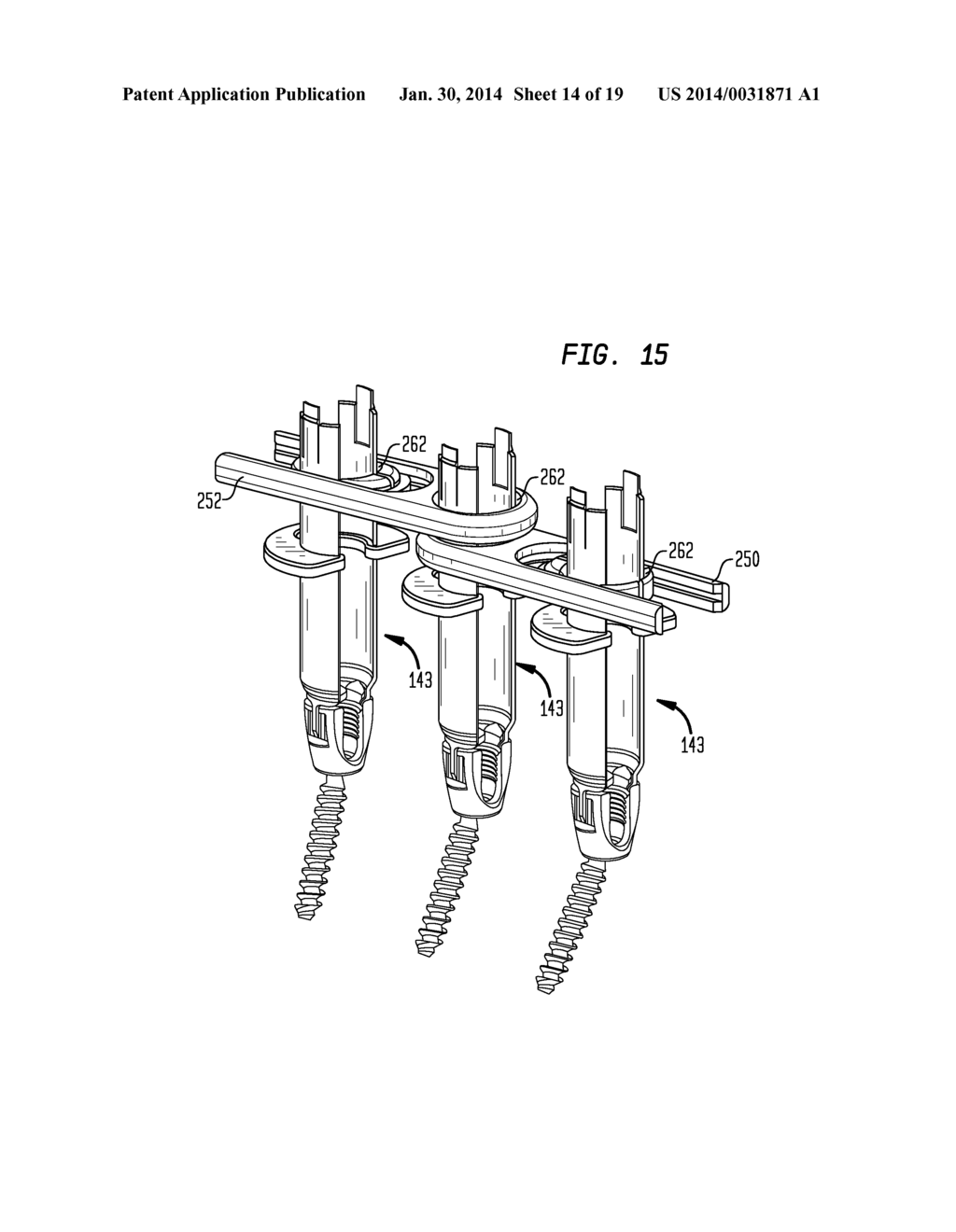 ROD CONTOURING METHOD FOR PERCUTANEOUS PEDICLE SCREW EXTENSION - diagram, schematic, and image 15